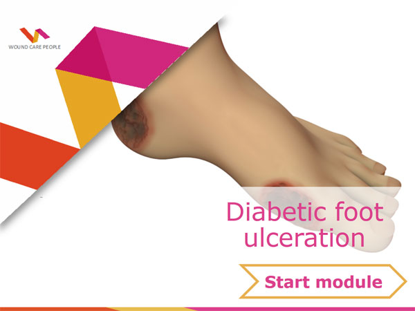 Diabetic foot ulcertation e-learning module