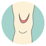 Kliniderm application - step 1