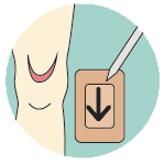 Kliniderm application - step 2